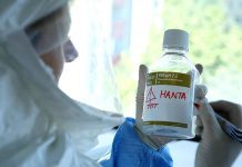 Sigue en grave estado mujer afectada por virus Hanta que está internada en Hospital del tórax en Santiago
