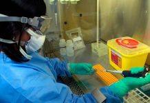 Seremi de Salud confirmó segundo caso por contagio de virus hanta en la región
