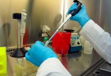 Epidemiólogo por lepra: »Hay que tener cuidado con estigmatizar a los extranjeros»