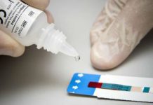 Invitan a realizarse test rápido de VIH en Universidad Santo Tomás de Osorno