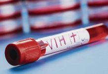 Chile: Entre los 10 países con mayor aumento de VIH