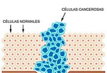 Científicos descubren método para detener la metástasis al transformar células cancerosas