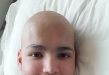 Osornino de 16 años necesita encontrar a su “gemelo genético” para seguir viviendo