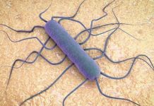 Alerta por Listeria: Grupos de riesgo son los más vulnerables