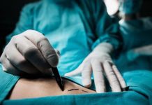 Espera para una cirugía no AUGE asciende a 574 días en promedio