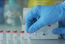 Covid-19: Fiestas Patrias podrían ser la causa del aumento de casos en la región según jefe de epidemiología