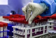 Estudio afirma que nueva cepa del coronavirus es hasta un 74% más contagiosa