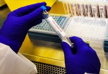 Minsal reporta 17 fallecidos y 1.389 nuevos contagios en el país de covid-19