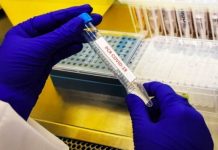 Reporte covid-19 : 393 nuevos casos y 7 fallecidos en al región de Los Lagos