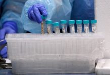 Uno de cada 10 casos de Covid-19 en Chile son de variante Delta
