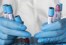 Salud confirma «preocupante» variante Mu en una familia de Castro