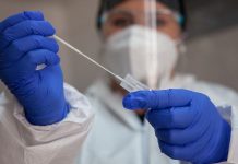 Confirman primer caso de viruela del mono en la provincia de Osorno