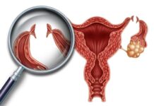 Lanzan programa de resolución de lista de espera de esterilización tubaria gracias a fondos del Gore Los Lagos