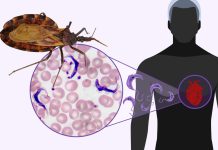 Llaman a embarazadas y personas que provengan del norte de Chile a hacerse exámenes para descartar mal de Chagas