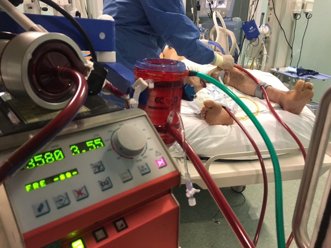 ecmo hanta