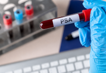 Cáncer de próstata cobra la vida de un hombre cada 15 días en Puerto Montt: refuerzan exámenes preventivos