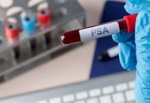 Cáncer de próstata cobra la vida de un hombre cada 15 días en Puerto Montt: refuerzan exámenes preventivos
