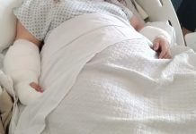 Vecinos de Puerto Montt exigen retirar perros que dejaron grave a mujer y piden querella municipal